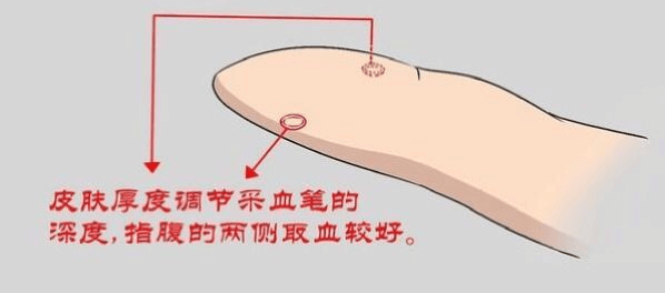  居家測血糖注意“五個要”